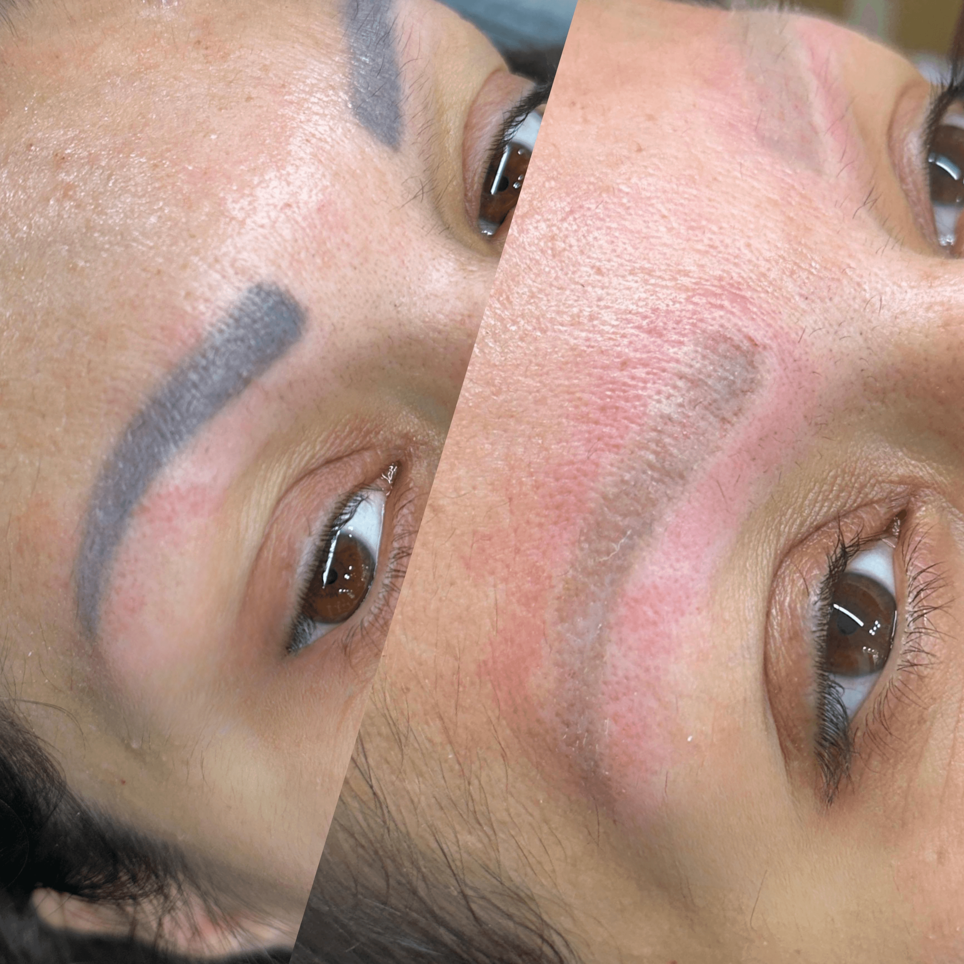 Hybrid Remover